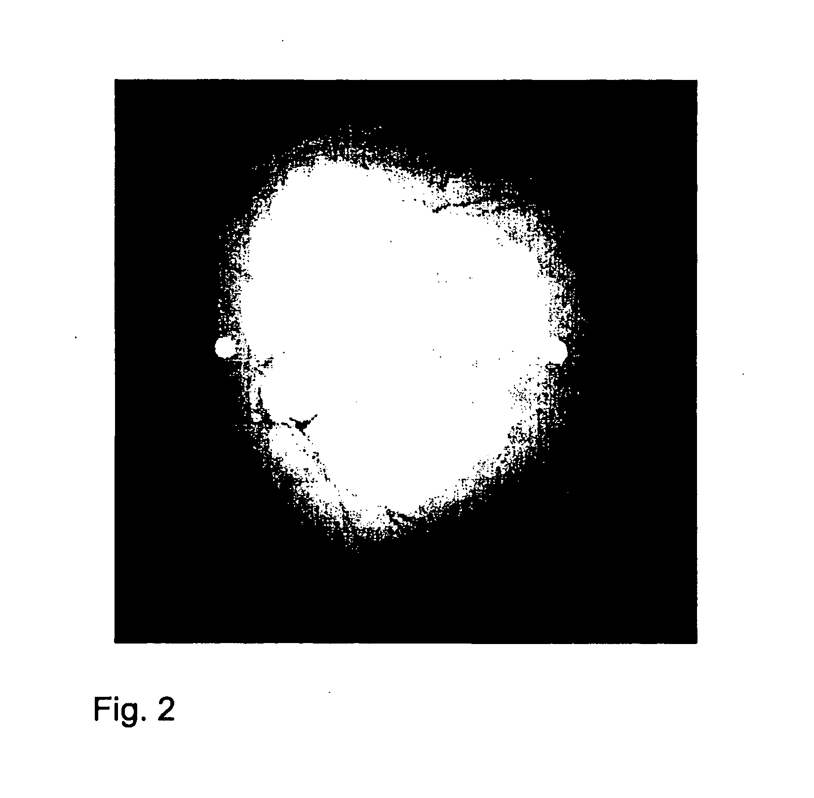 Arrangements and method for measuring an eye movement, particularly a movement of the fundus of the eye