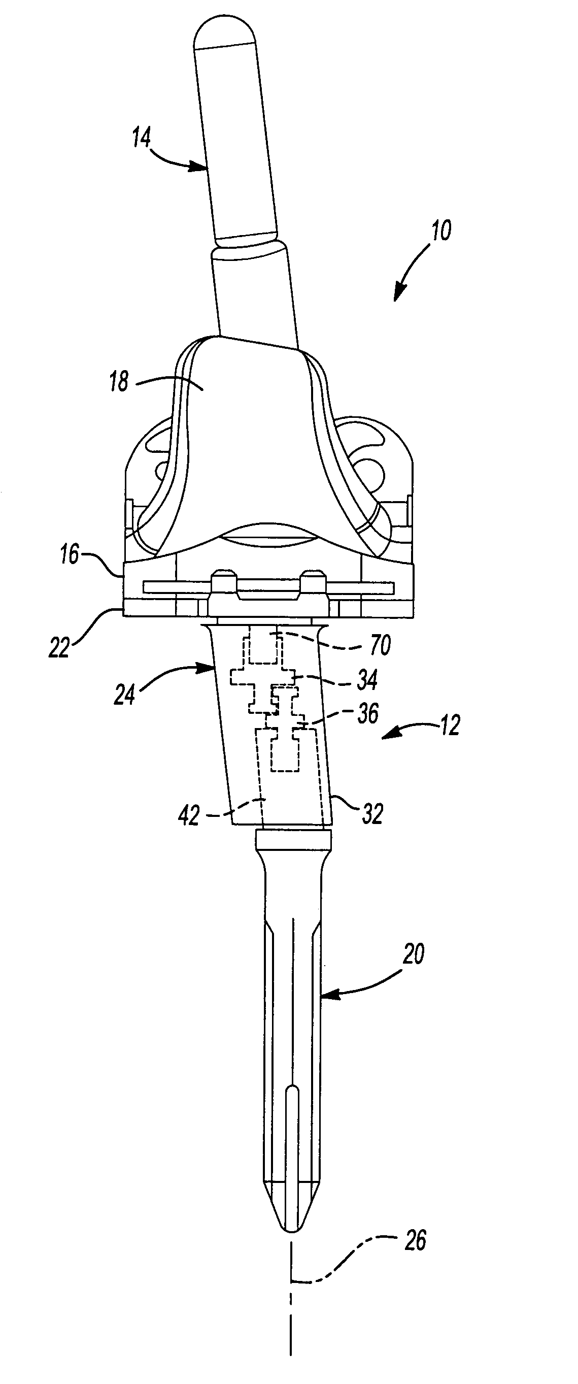 Knee joint prosthesis