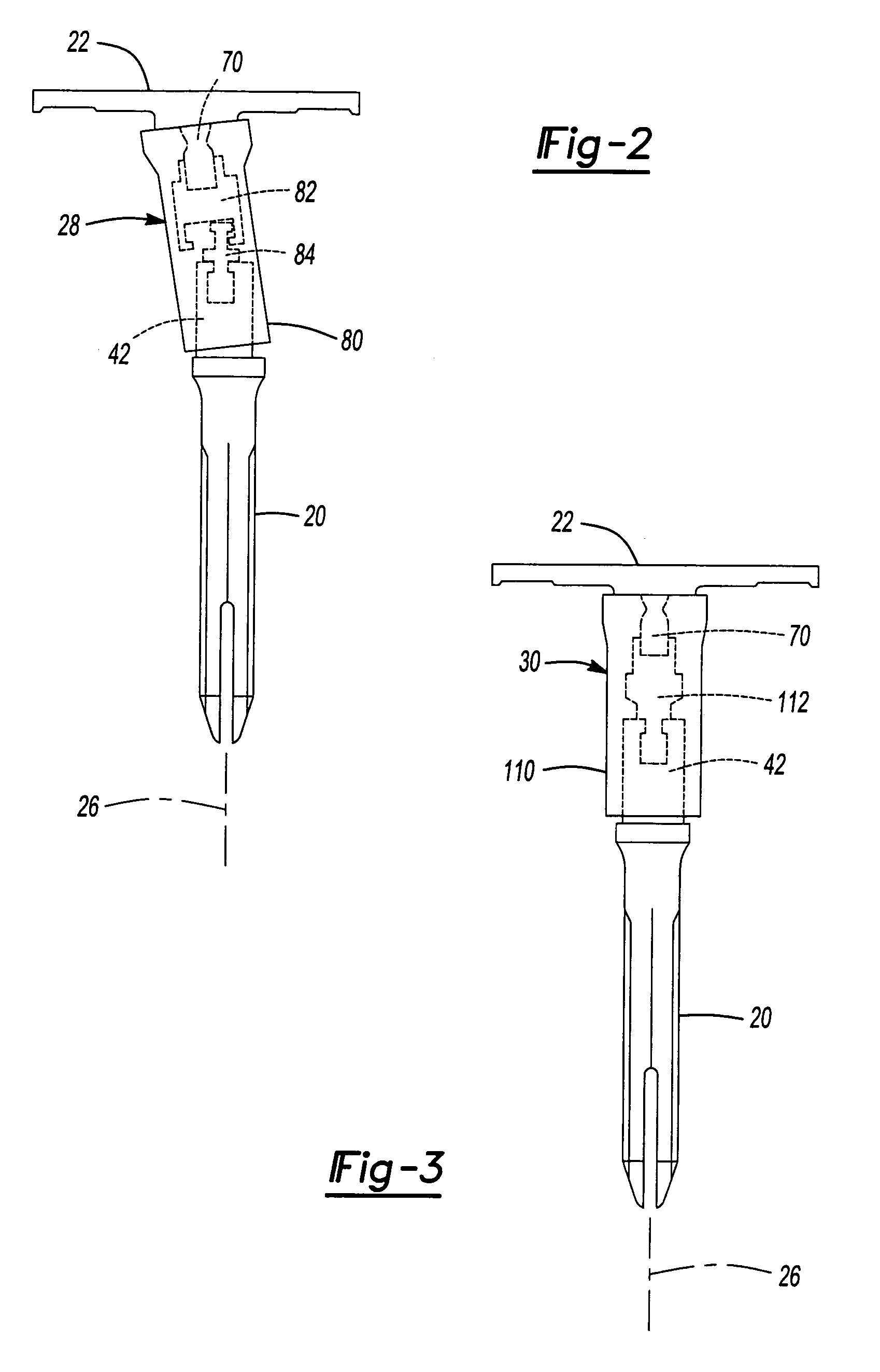 Knee joint prosthesis