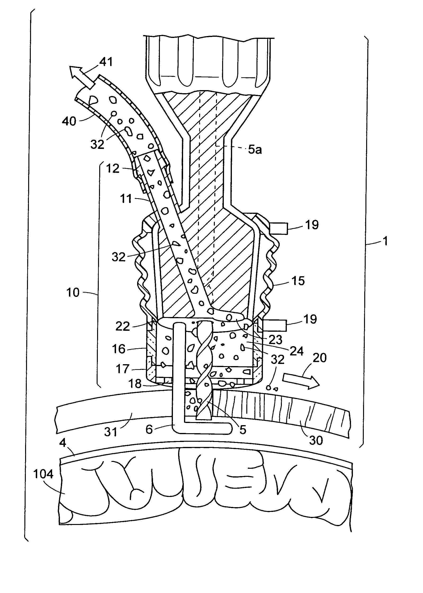 Autologous bone harvest during osteotomy and bone drilling procedures