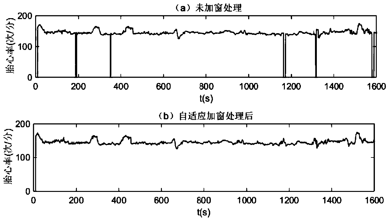 A time-domain adaptive windowing fetal heart sound noise reduction technology