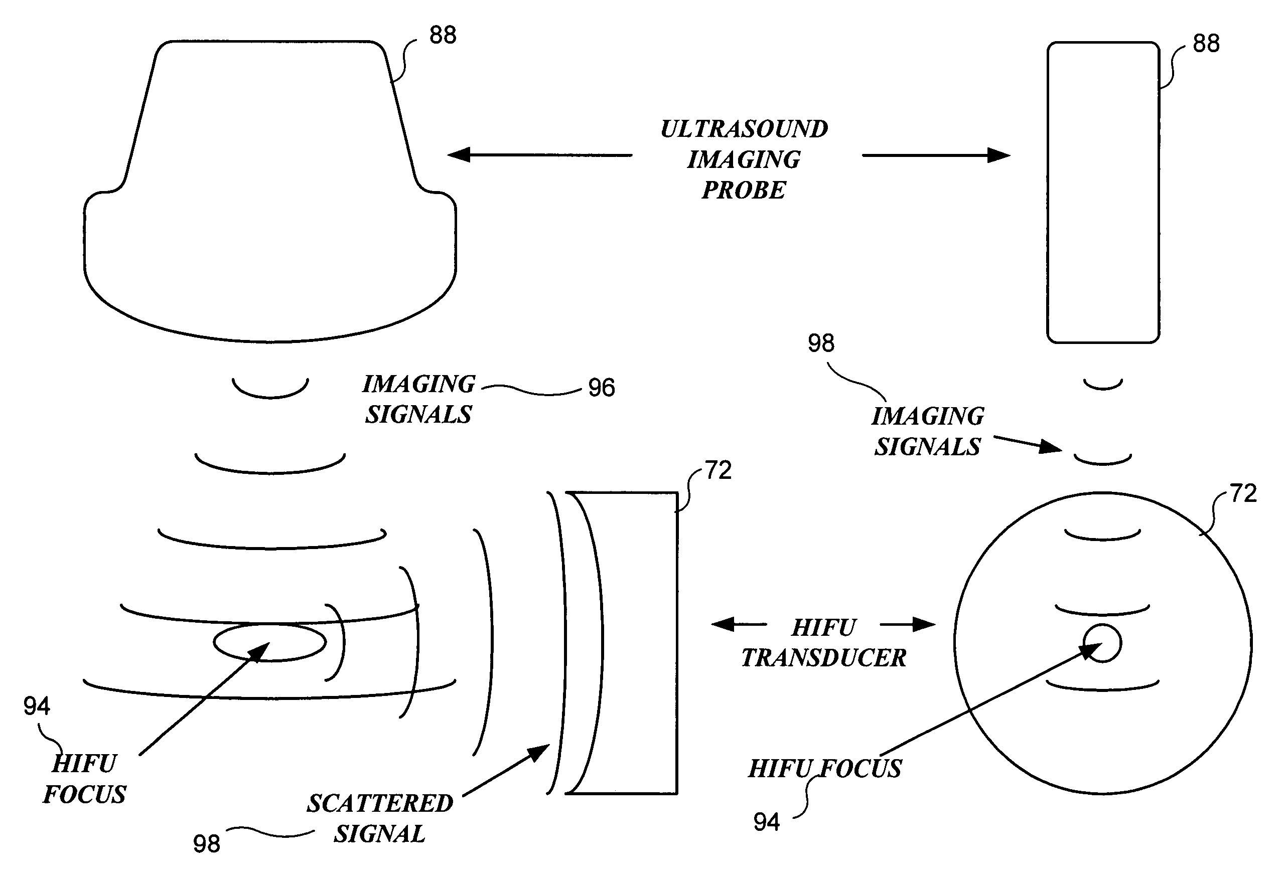 Method and system to synchronize acoustic therapy with ultrasound imaging