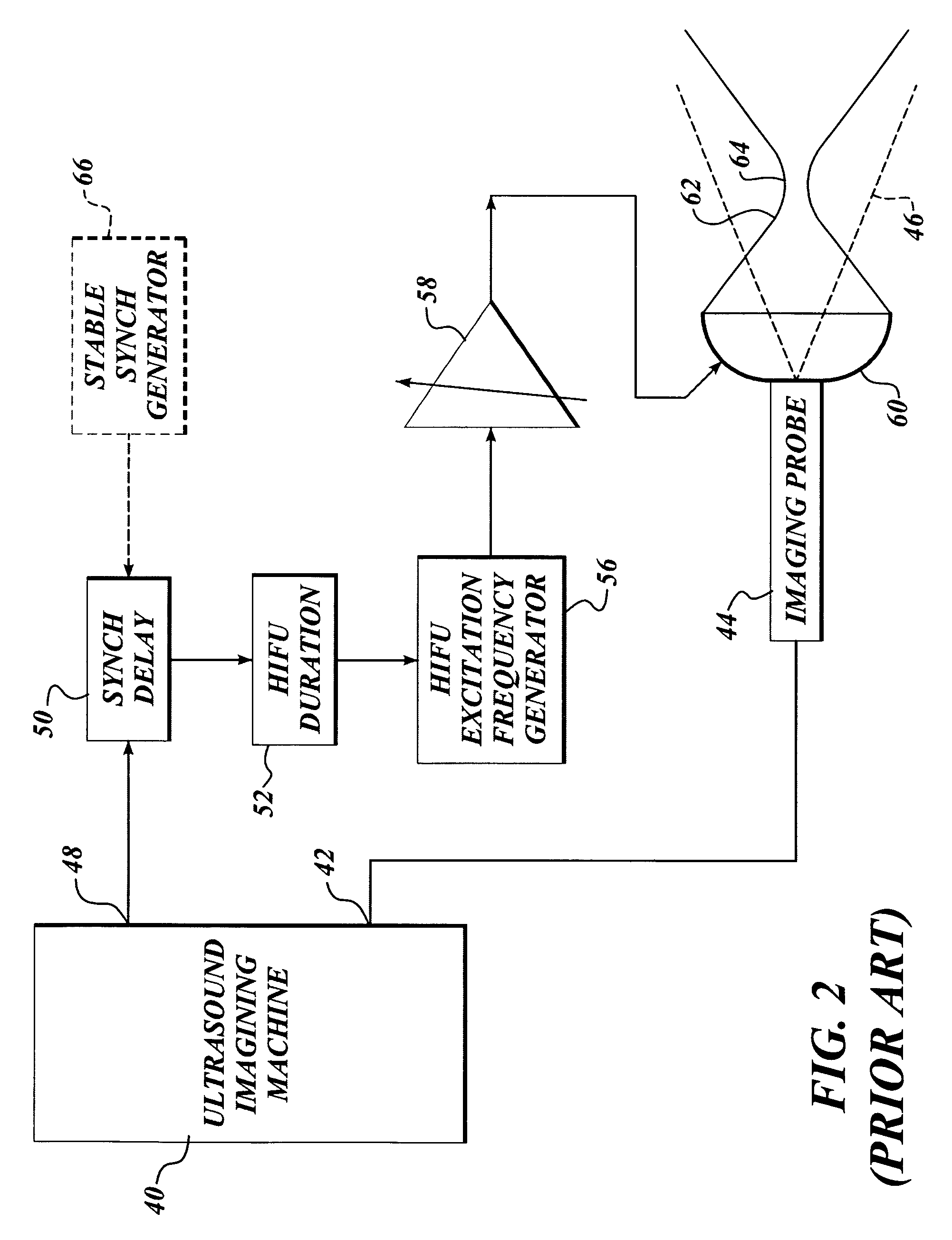 Method and system to synchronize acoustic therapy with ultrasound imaging