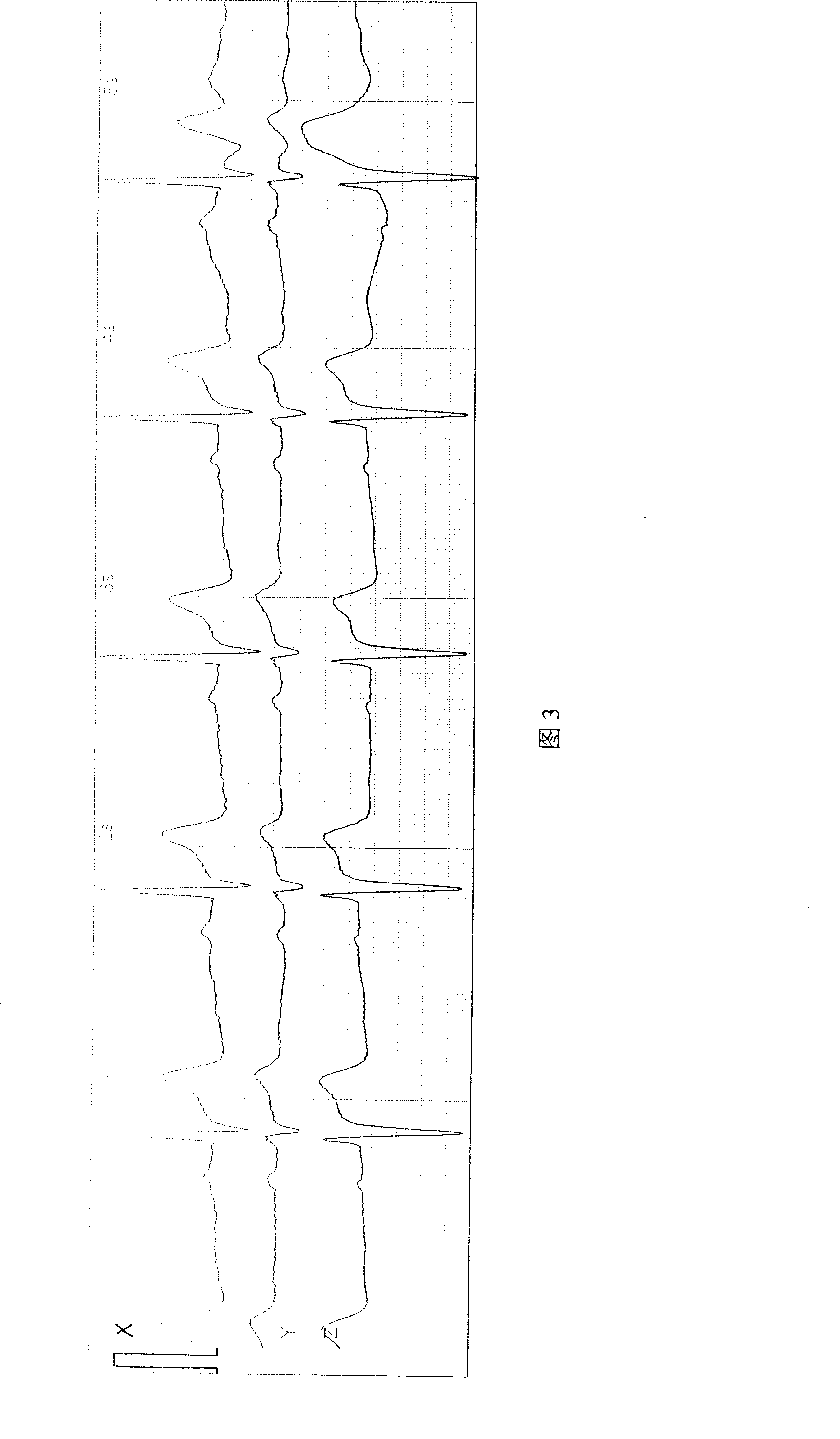 Electrocardiograph with three-dimensional image and method for implementing same