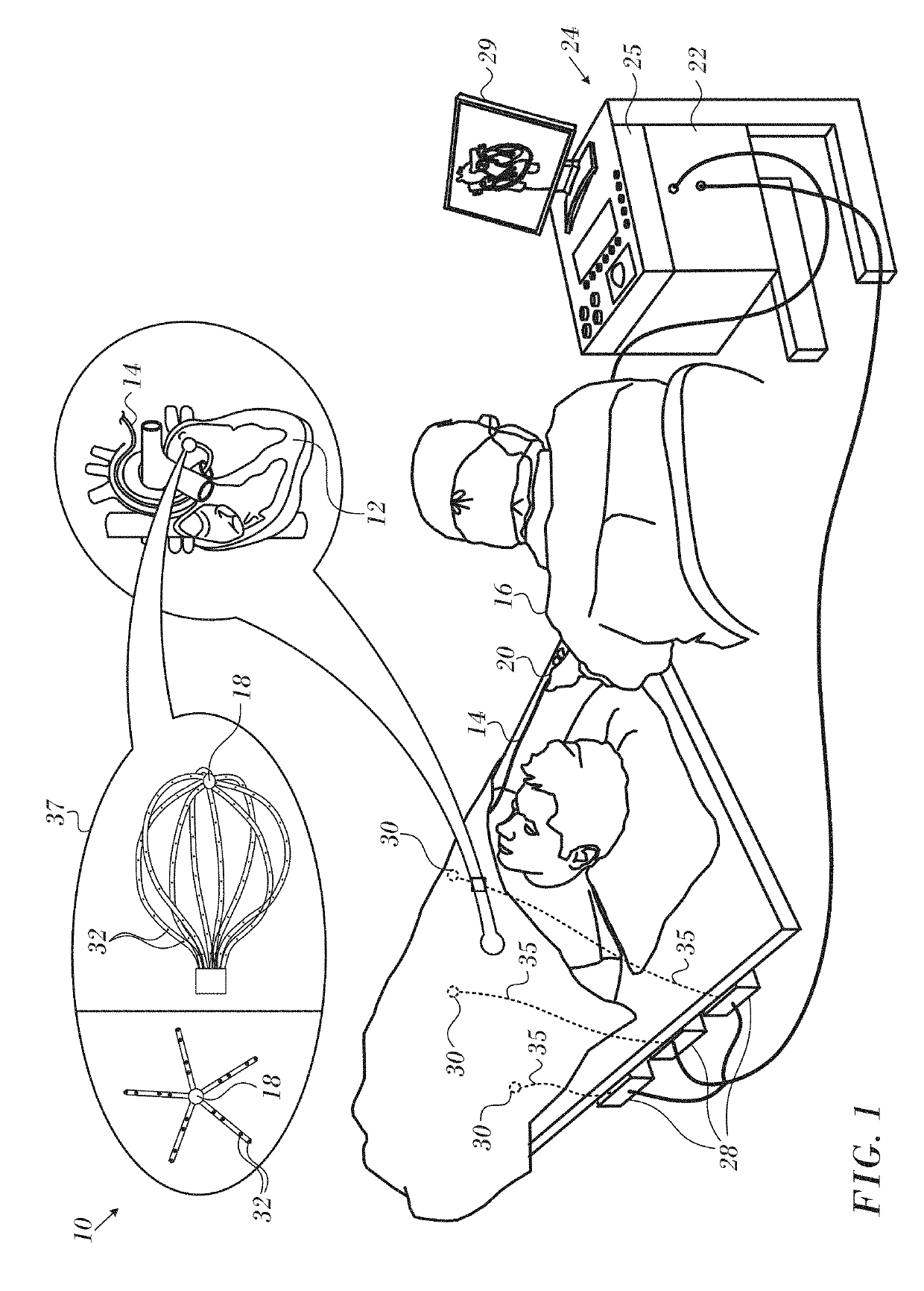 Automatic display of earliest LAT point