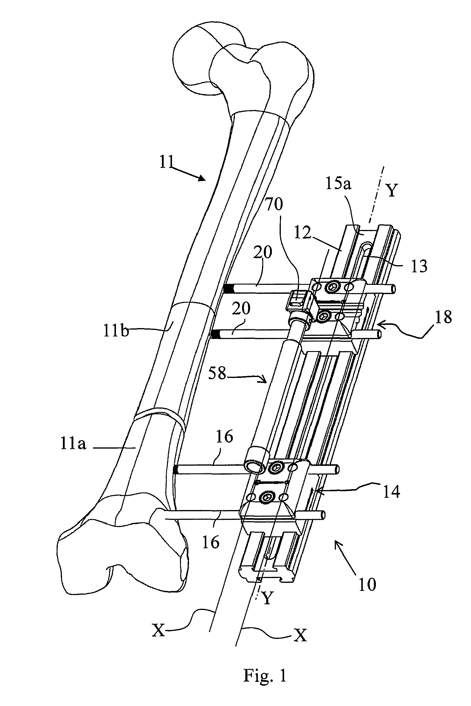 Orthopaedic device to be associated with the outside of a bone