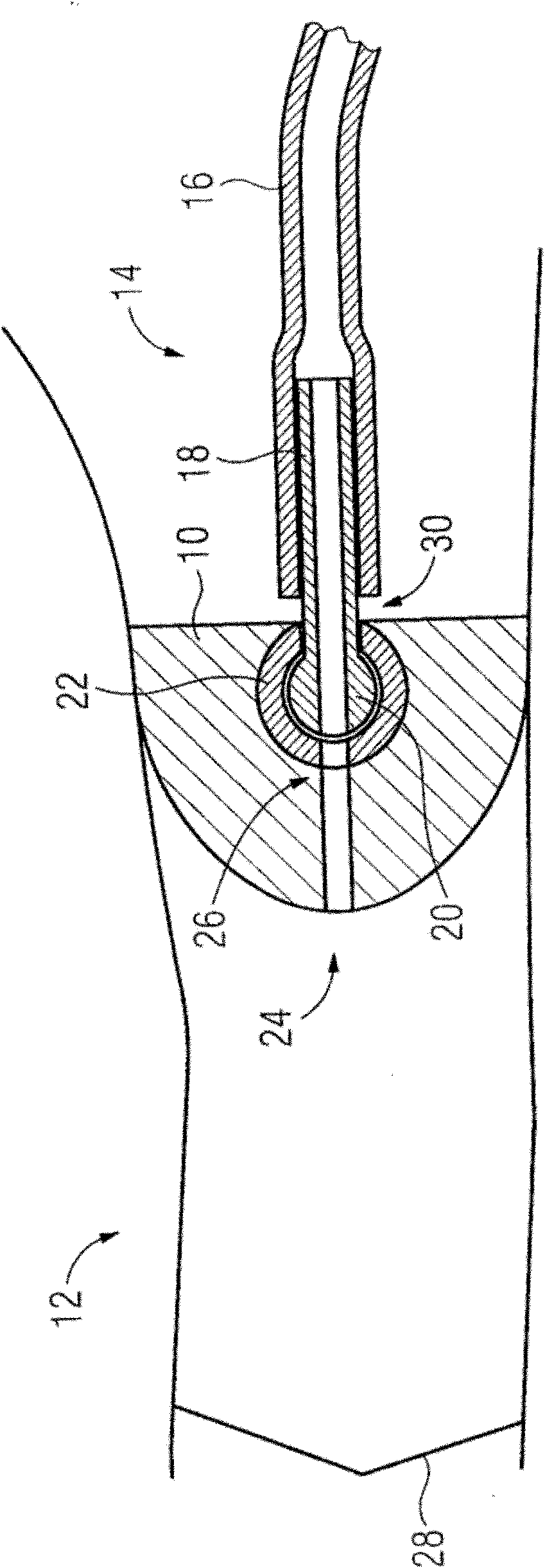 Hearing aid with removable attached earpiece