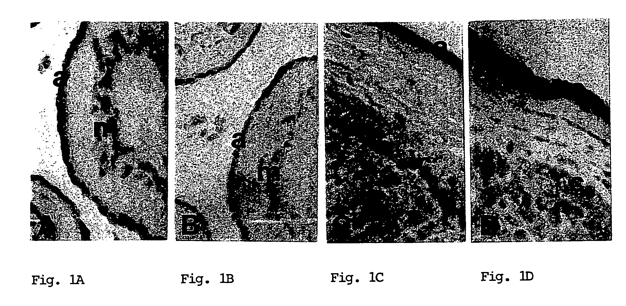 Methods for diagnosing labor