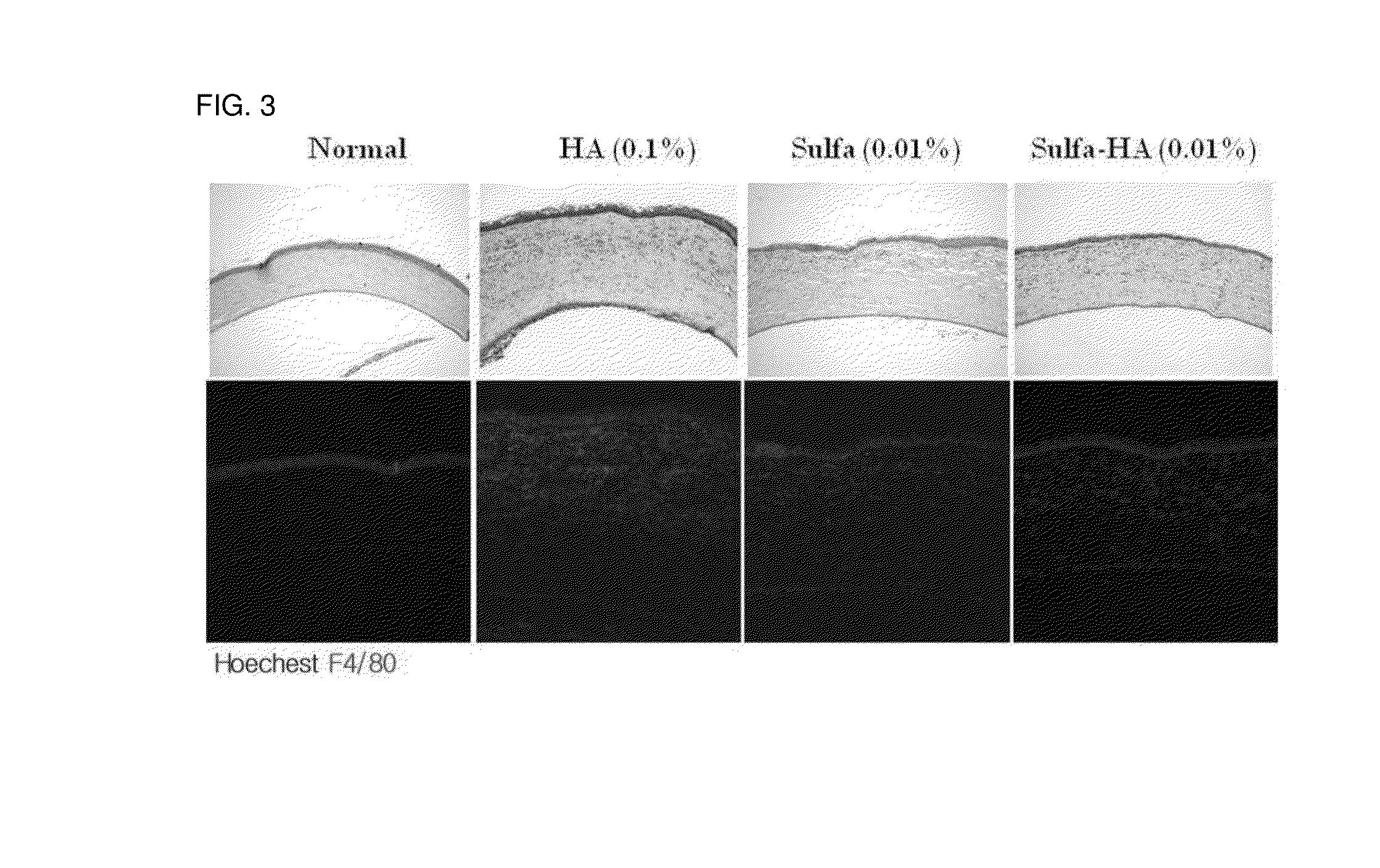 Eye drop composition for treating ocular inflammatory disease and preparation method therefor