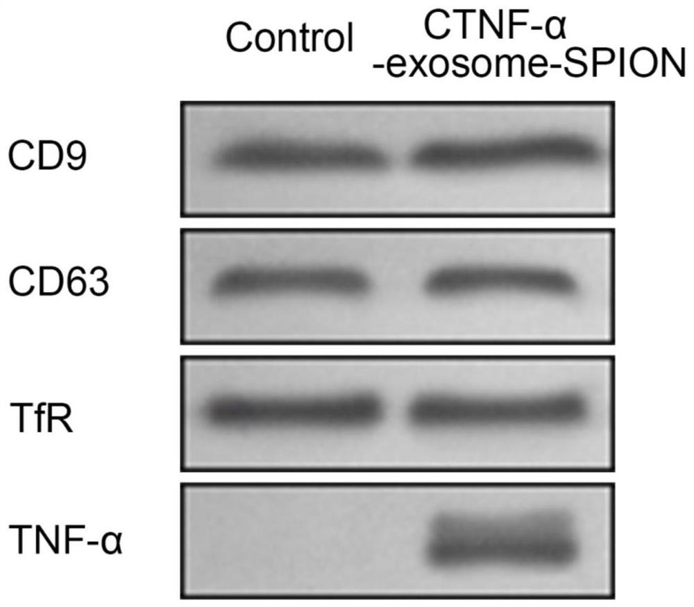 Polypeptide drug exosome nano-loading system targeting cell membrane and preparation method thereof