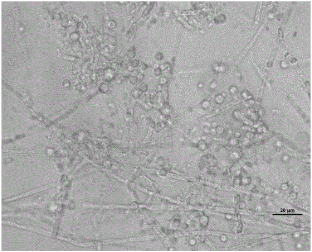 Preparation and conversion method of inonotus obliquus protoplast