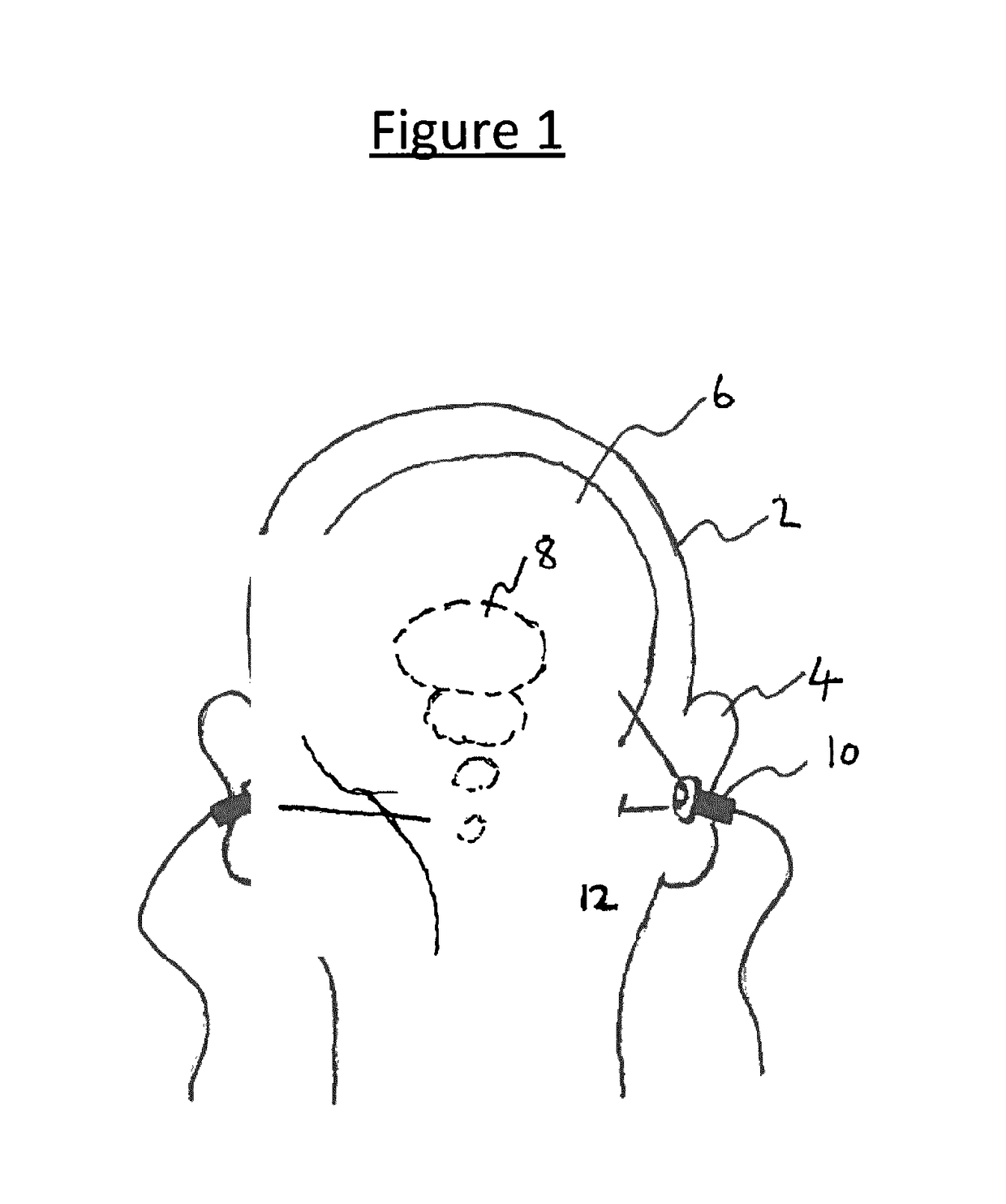 Non-ocular photo-biological stimulation