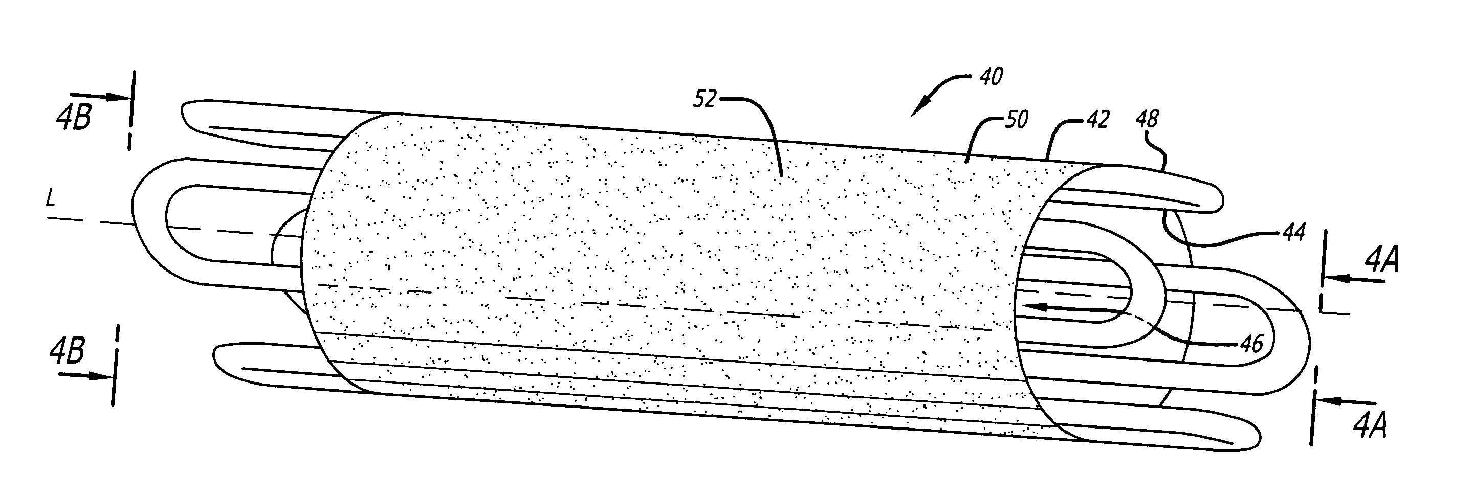 Semi-directional drug delivering stents