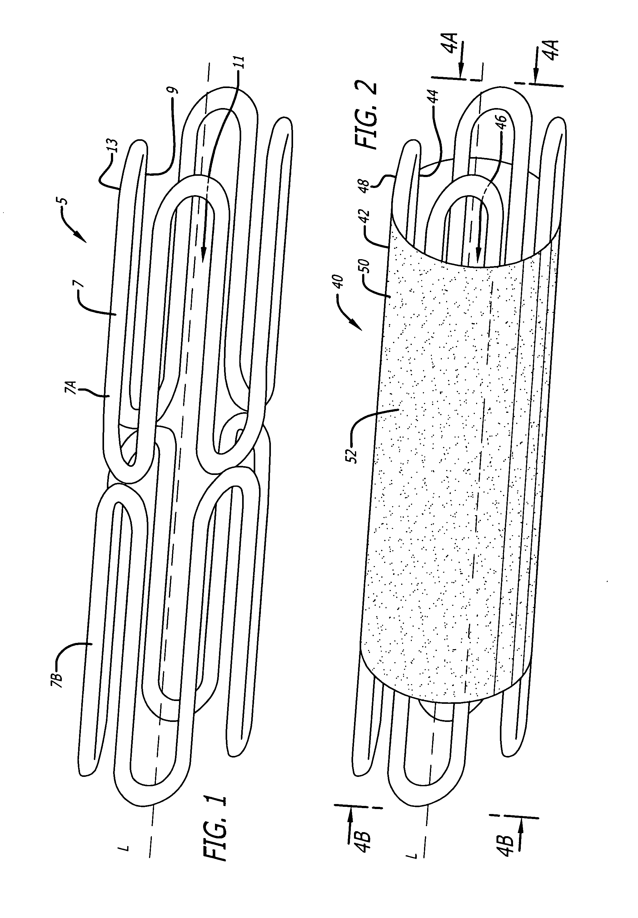 Semi-directional drug delivering stents