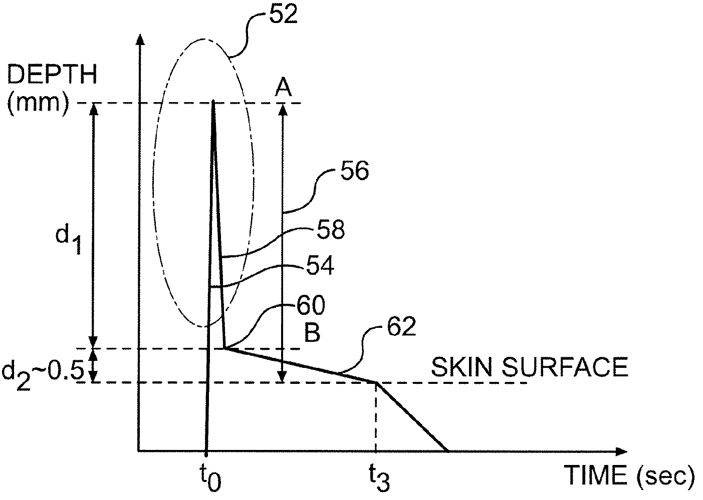 Method and device for the extraction of a body fluid