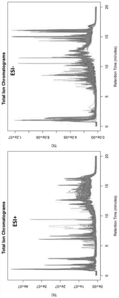 Application of methylmalonic acid as biomarker in predicting heart failure after myocardial infarction