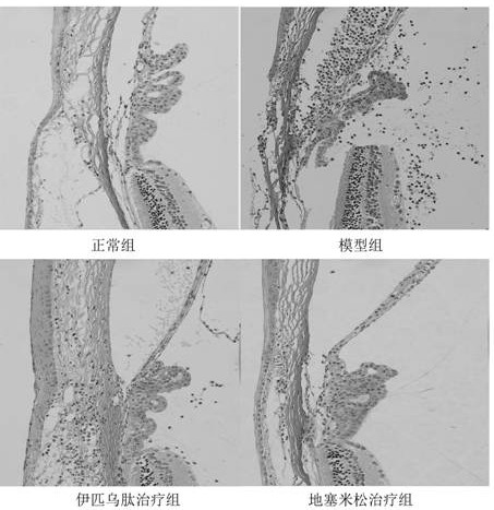 Application of polypeptide in medicine for treating eye inflammation