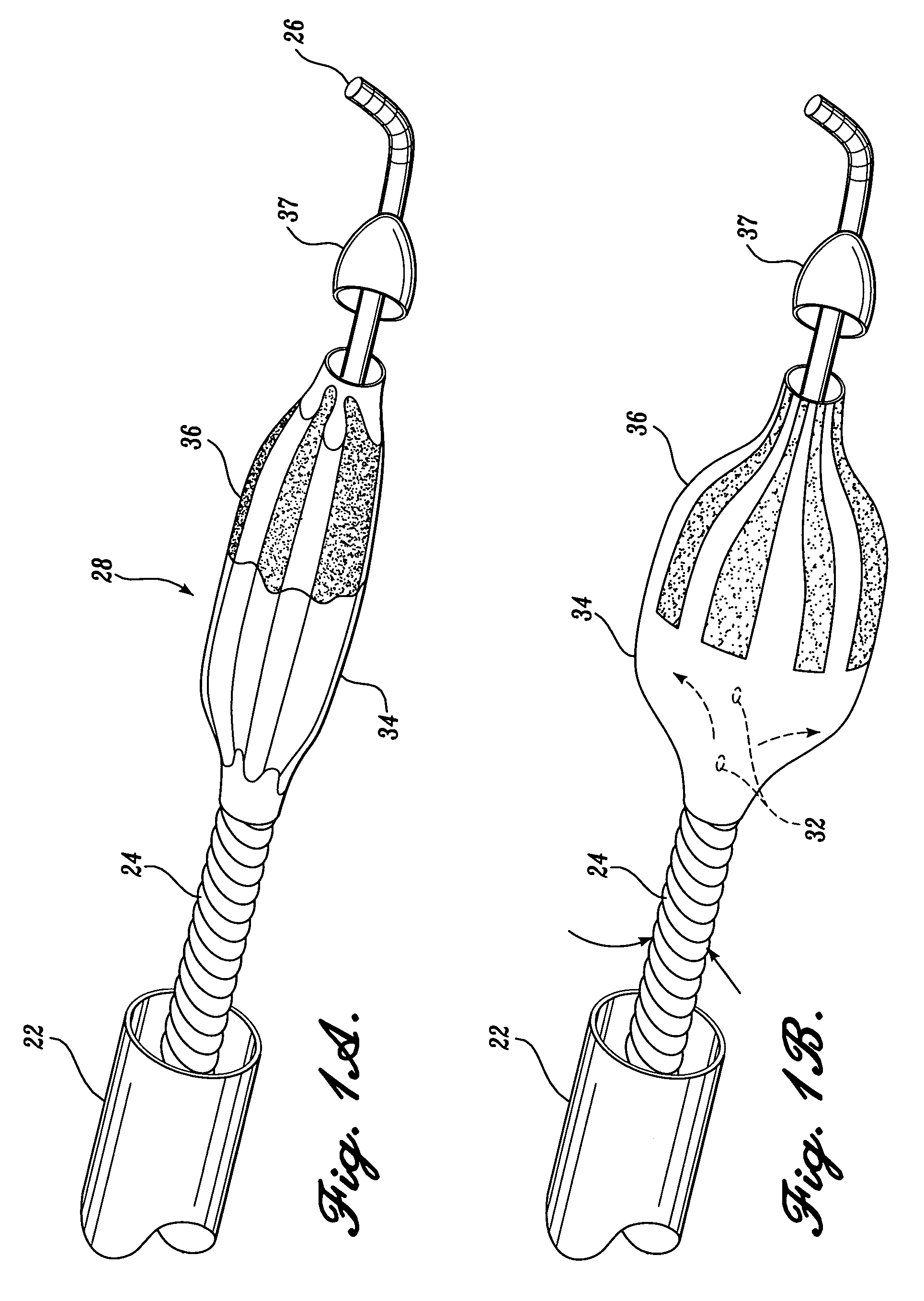 Expandable ablation burr