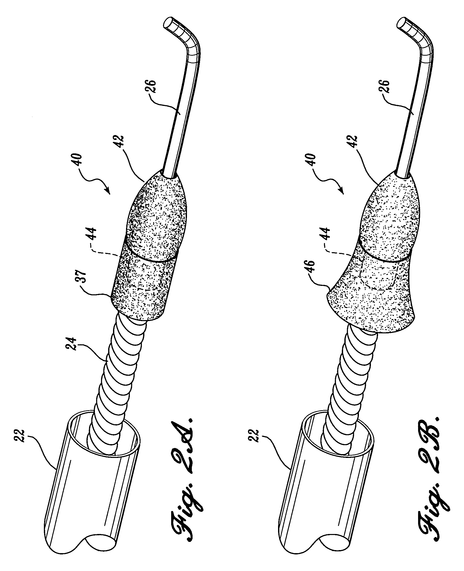 Expandable ablation burr