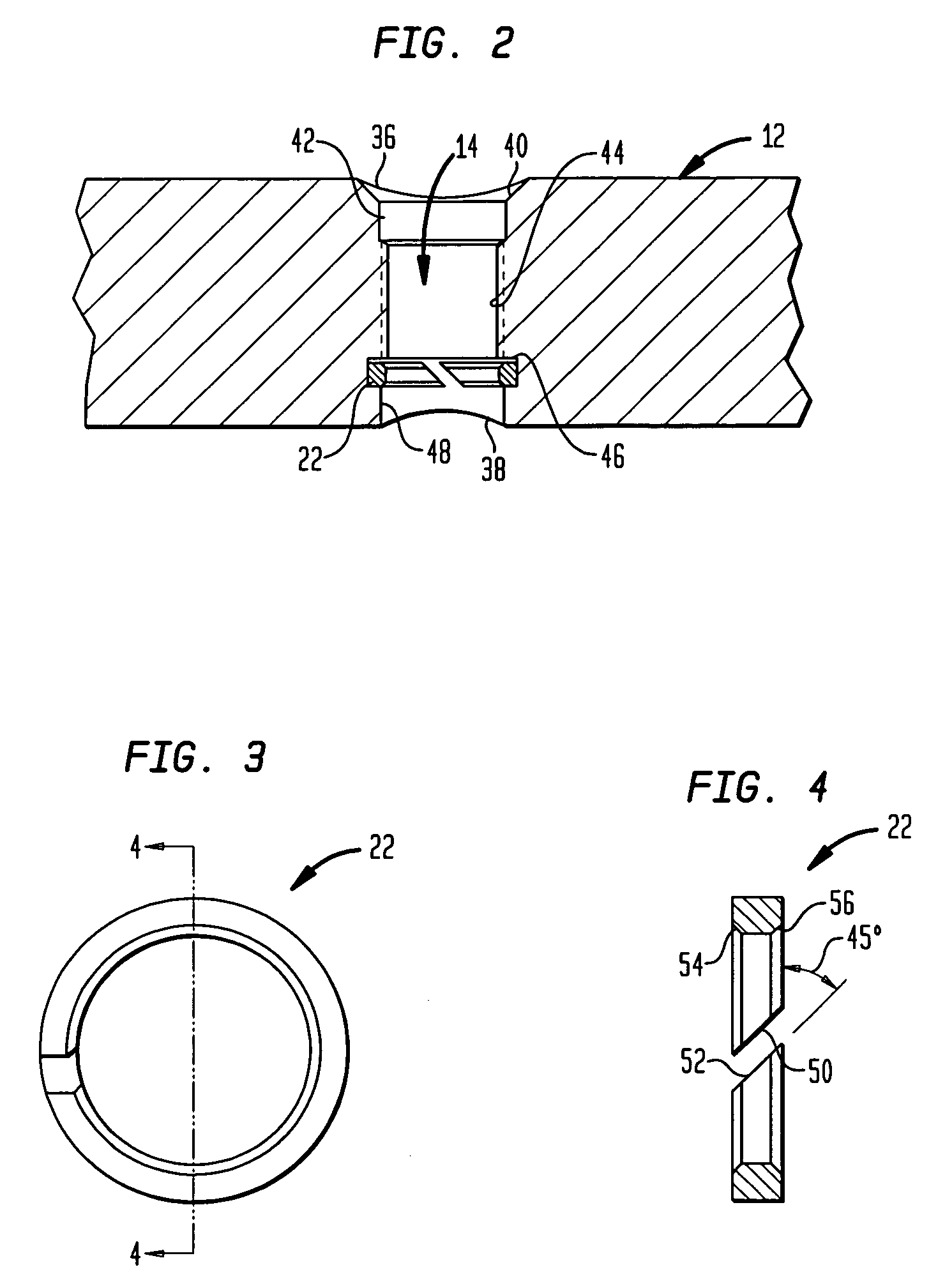 Implant for osteosynthesis