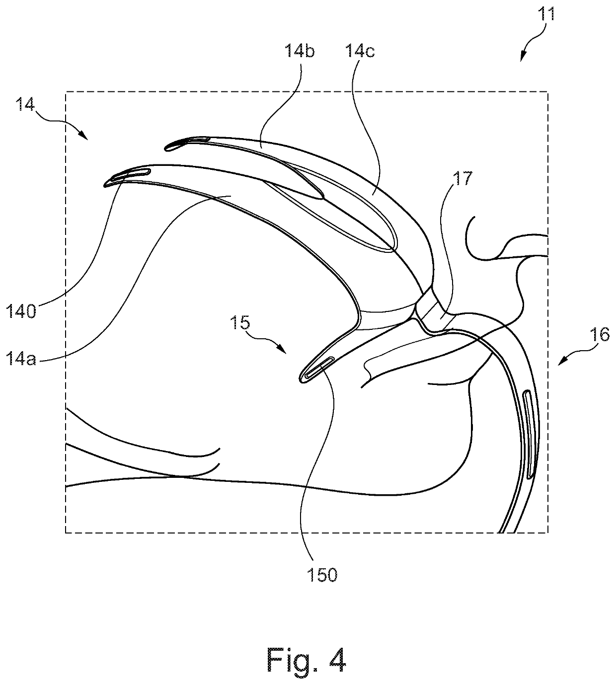 Method and apparatus for treating dysphagia