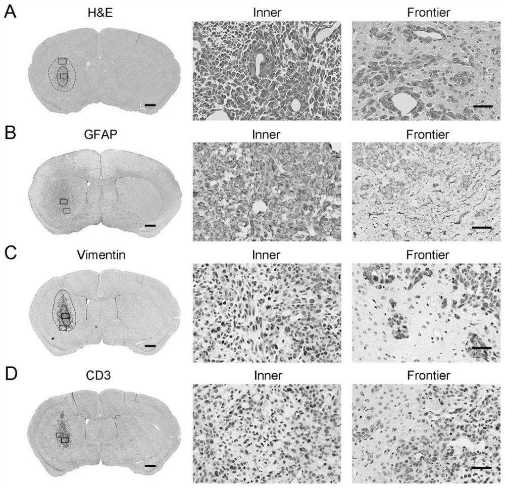 Mouse triple-negative primary glioblastoma cell strain and application thereof