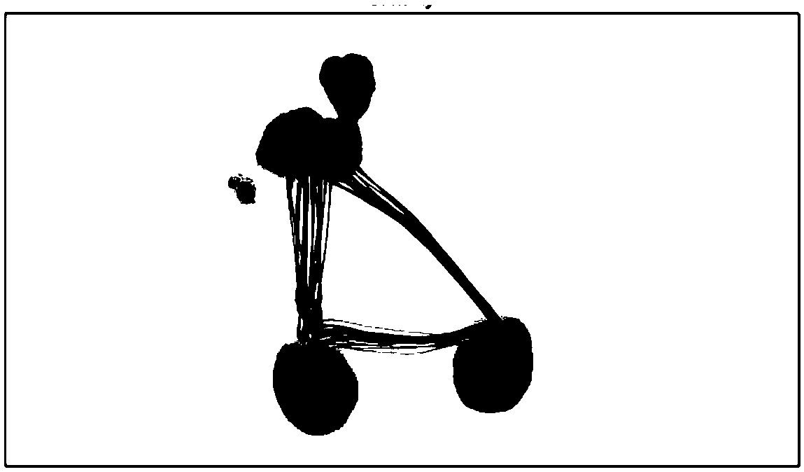 Method for evaluating gait mode of patient with unilateral achilles tendon rupture in rehabilitation period