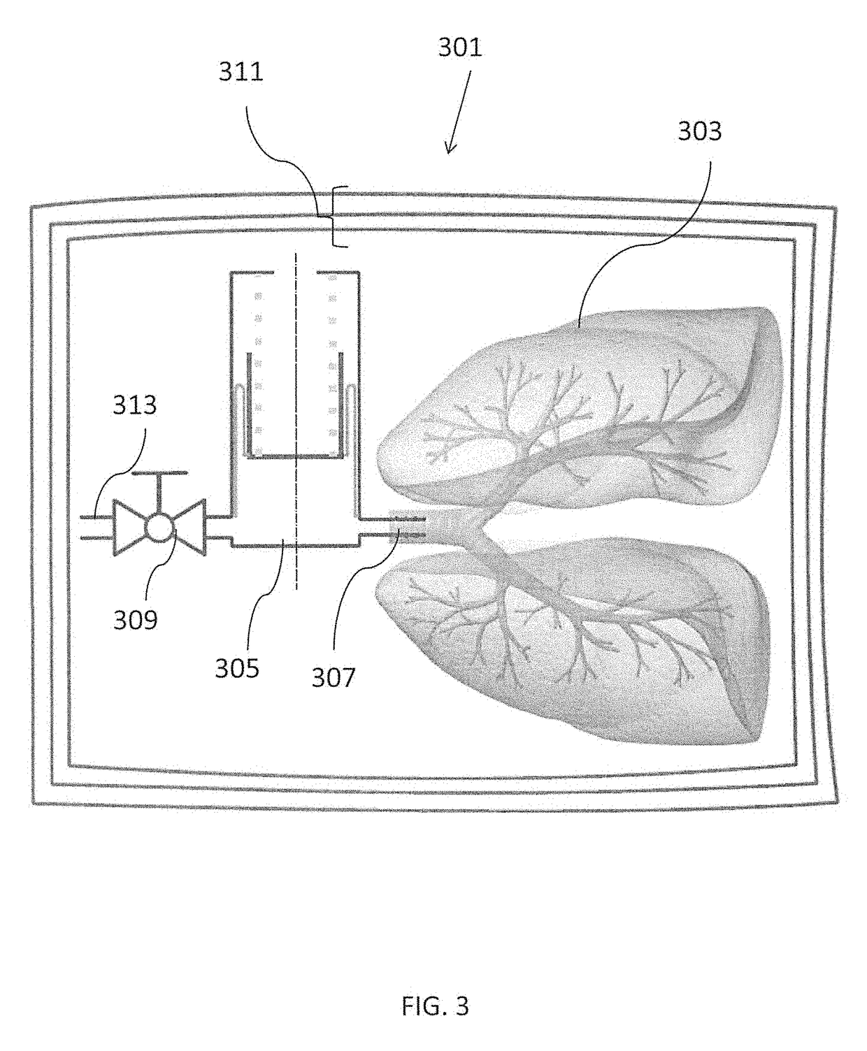 Apparatus for tissue transport and preservation