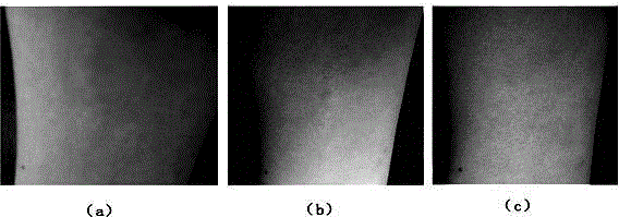 Short peptide for bacterium resisting, itching relieving, inflammation diminishing, swelling eliminating and scar removing, and its application