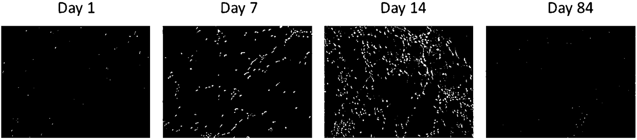 Induced differentiation method of functional cerebral cortical cells