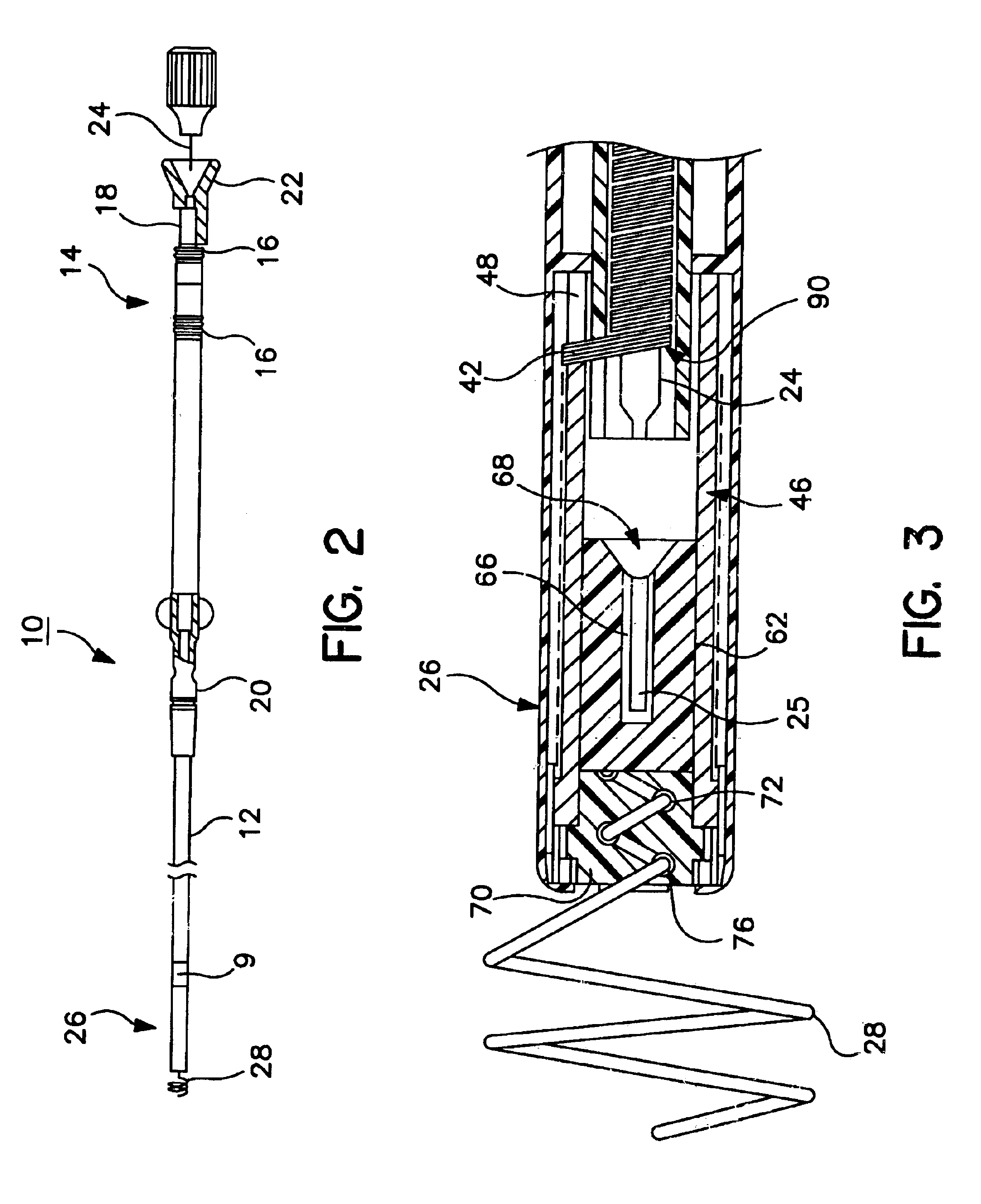 System and method for positioning an implantable medical device within a body