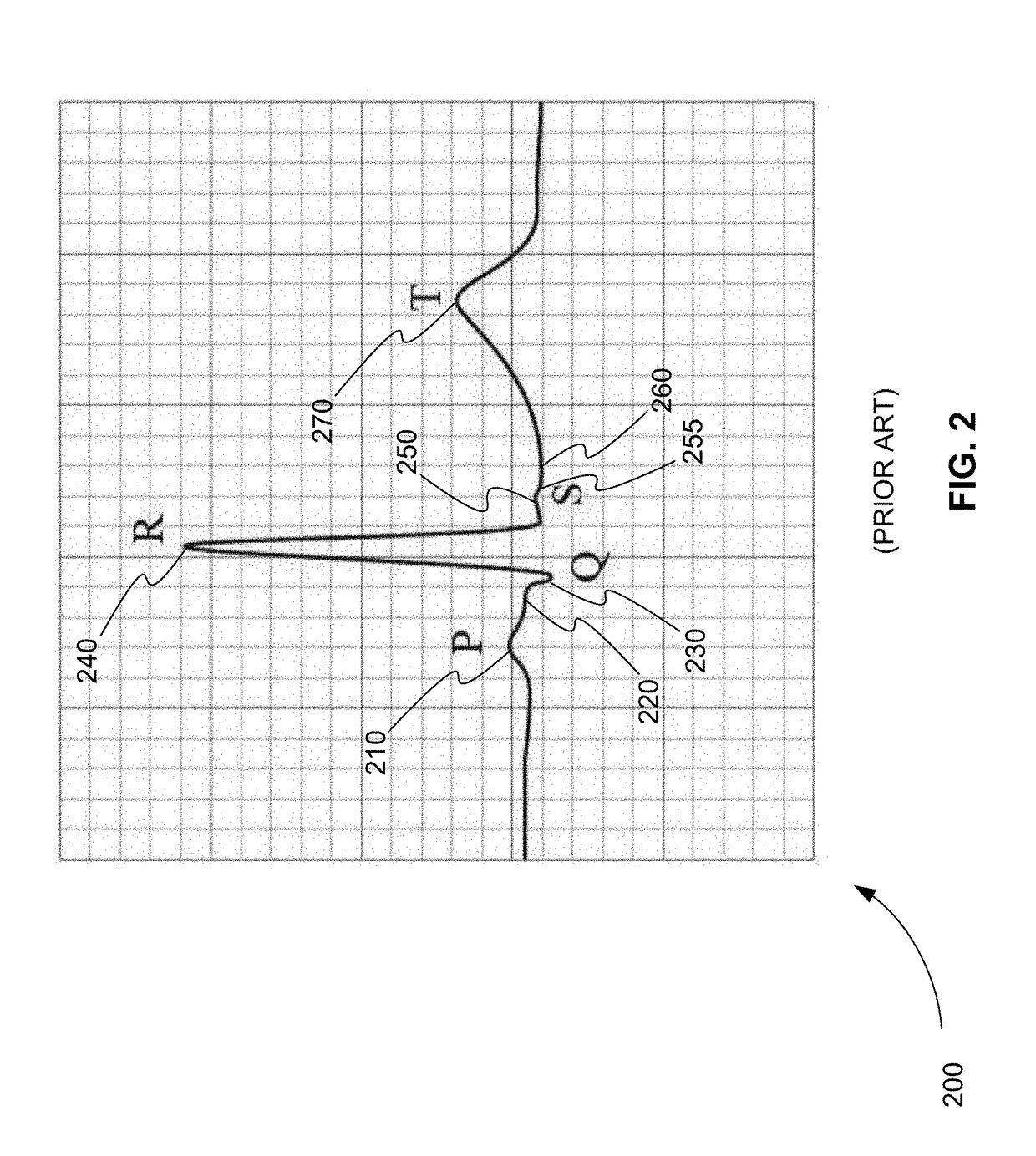 Electronic Acoustic Stethoscope with ECG