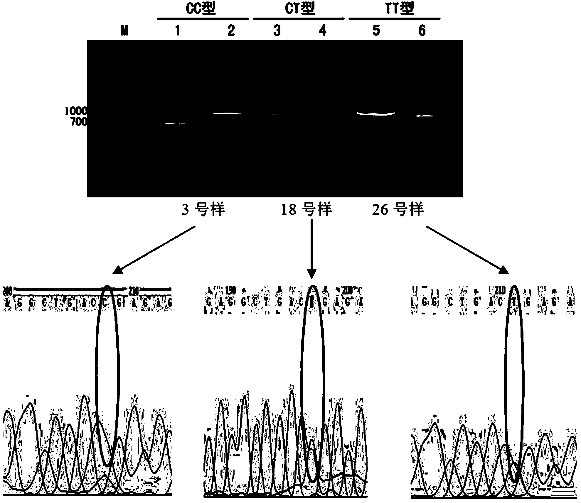 Speed or explosive power relative gene-ACTN3 (Alpha-Actinin 3) polymorphism rapid detection kit and detection method