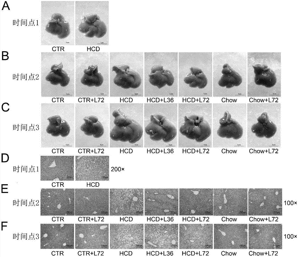 Application of deferoxamine to preparation of medicine for treating nonalcoholic fatty liver