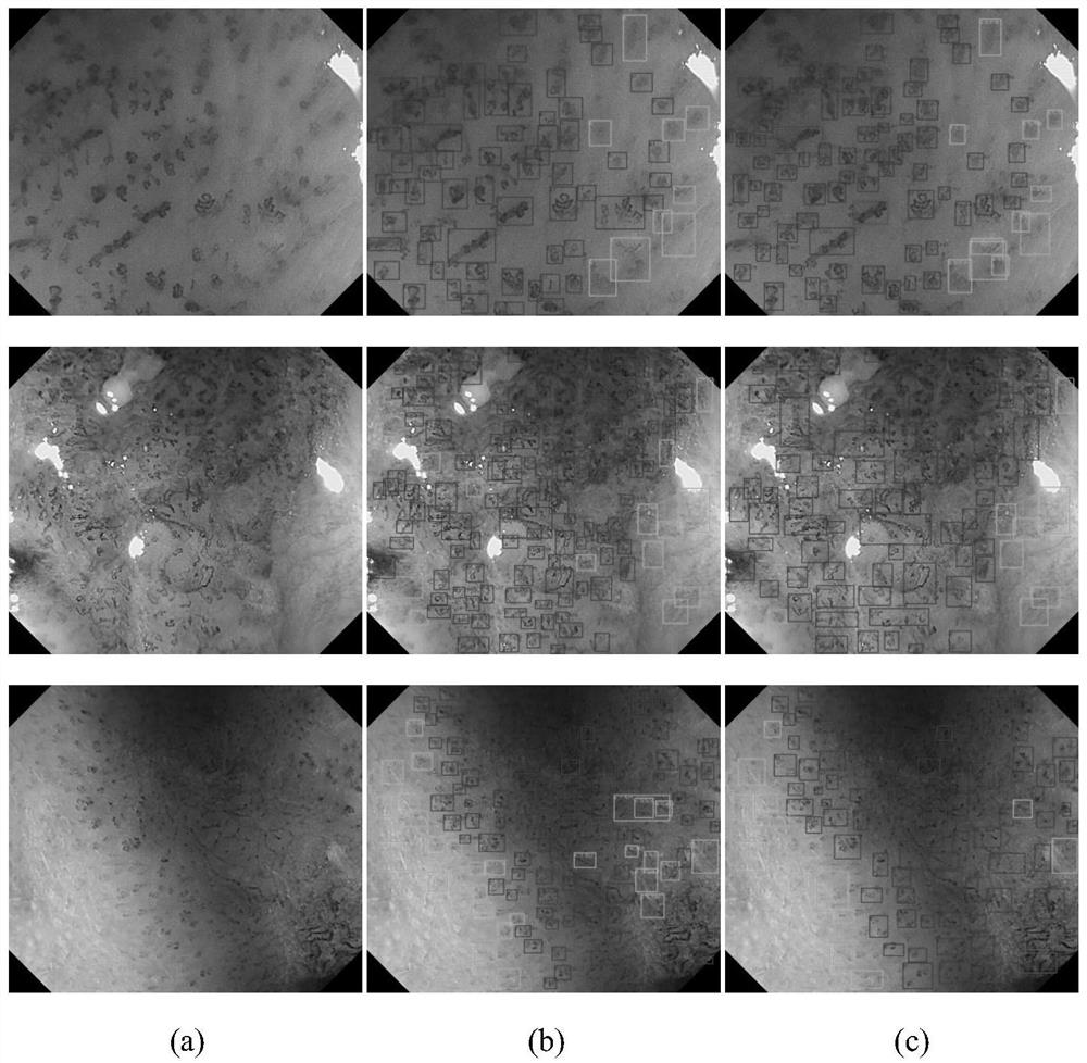 Deep detection network for quantifying esophageal mucosa IPCLs vascular morphological distribution