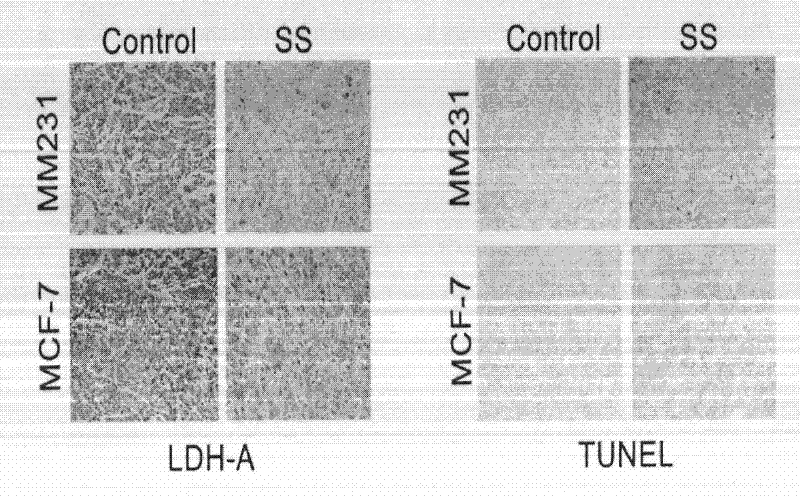 Caulis Spatholobi extract, application thereof and new application of isoliquiritigenin