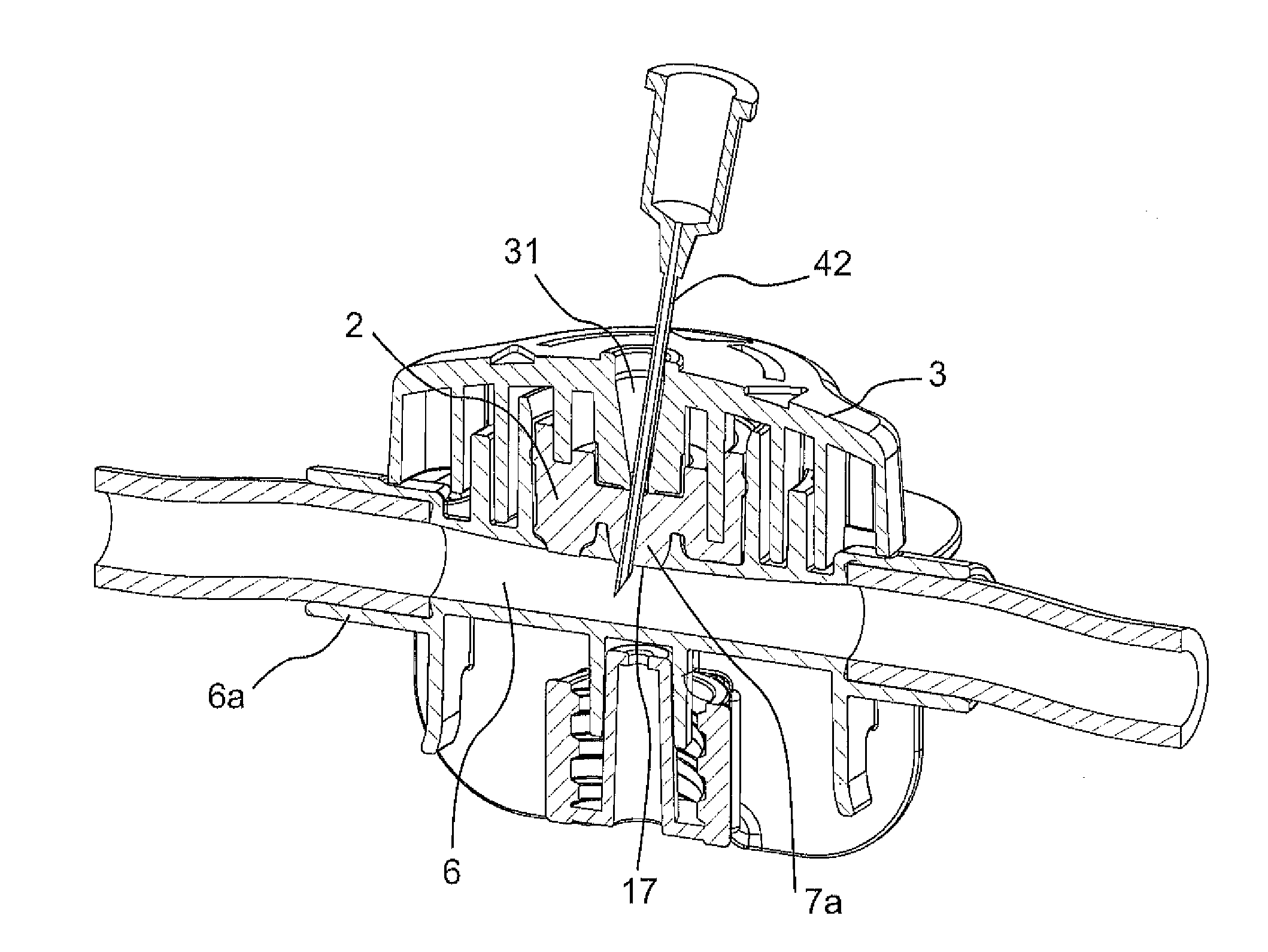 Medical port, blood hose for use in an extracorporeal blood treatment as well as medical treatment appratus