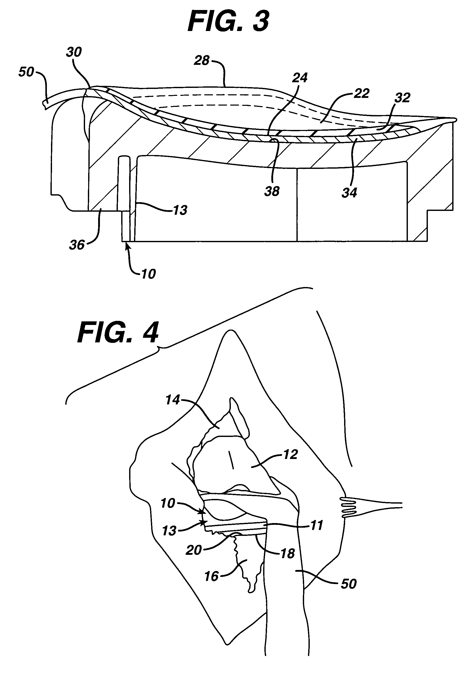 Apparatus, system and method for intraoperative performance analysis during joint arthroplasty