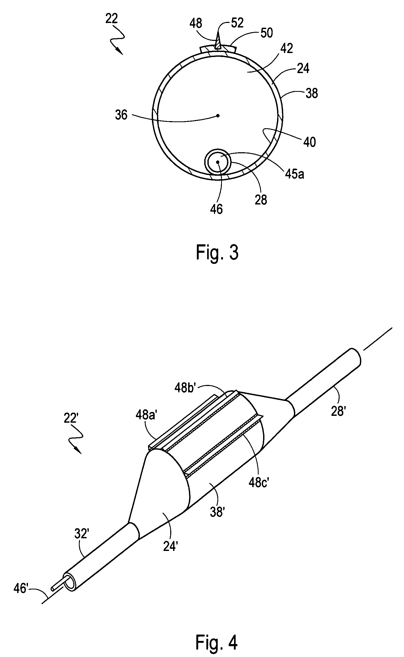 Directional cutting balloon