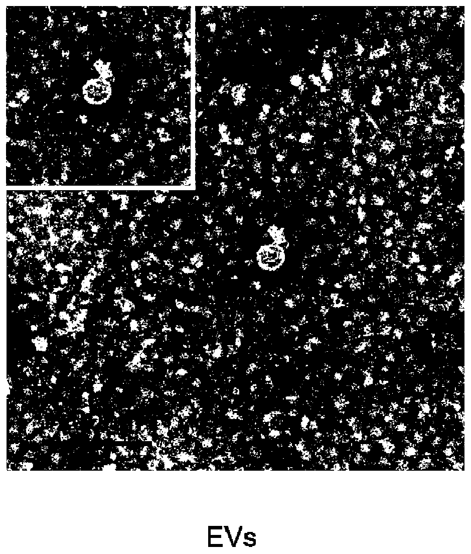 Carboxymethyl chitosan modified drug-carrying vesicle, and preparation method and application thereof