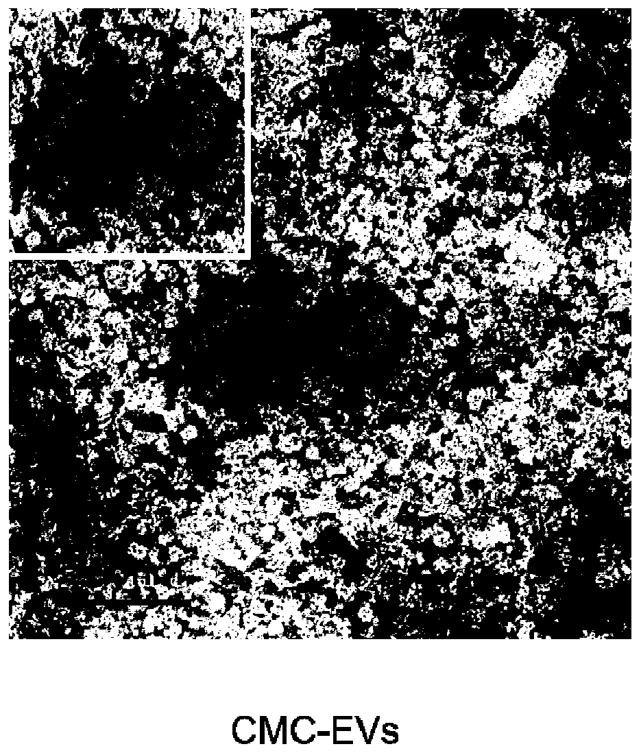 Carboxymethyl chitosan modified drug-carrying vesicle, and preparation method and application thereof