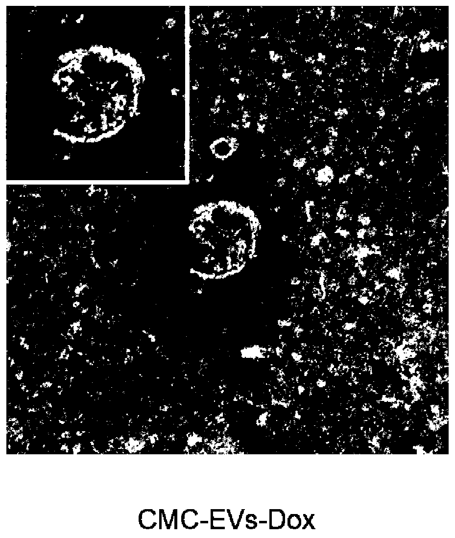 Carboxymethyl chitosan modified drug-carrying vesicle, and preparation method and application thereof