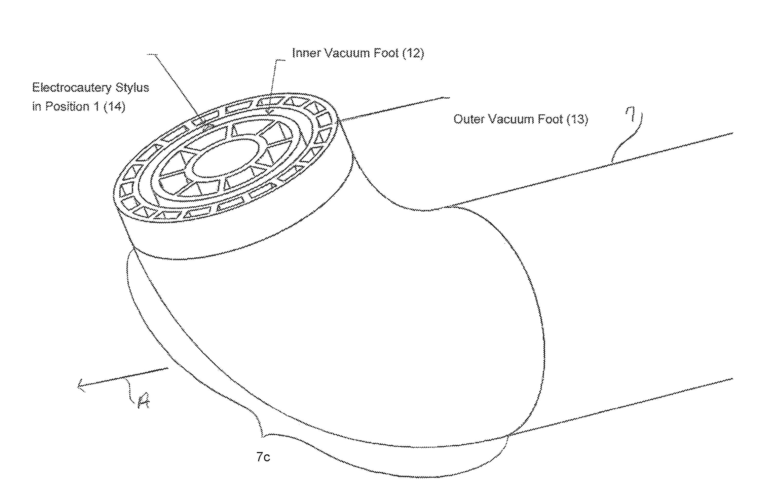 Dual vacuum device for medical fixture placement including for thoracoscopic left ventricular lead placement