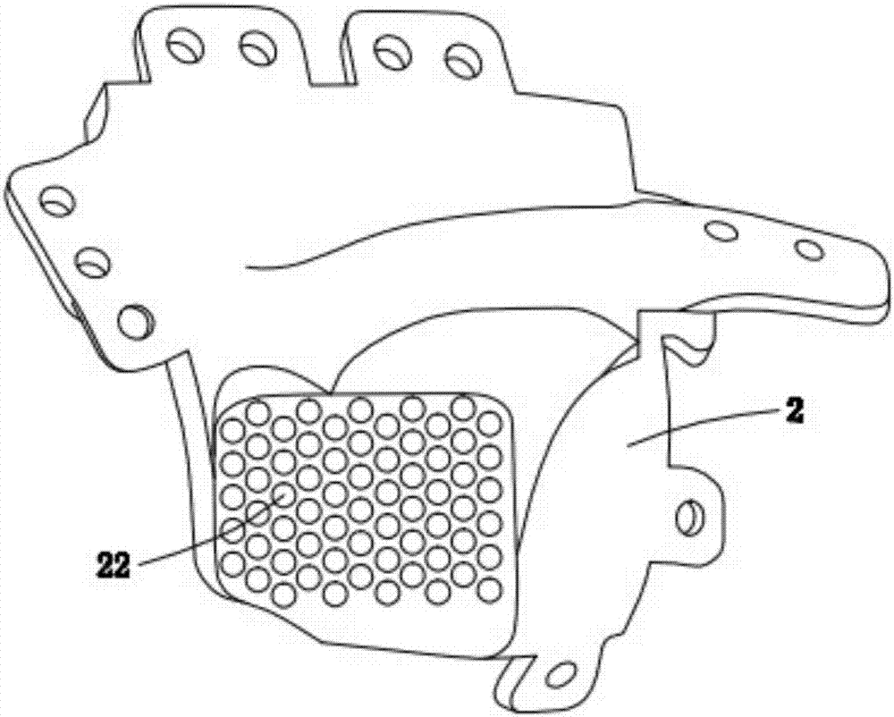 Basis cranii-temporo-mandibular joint combination prosthesis