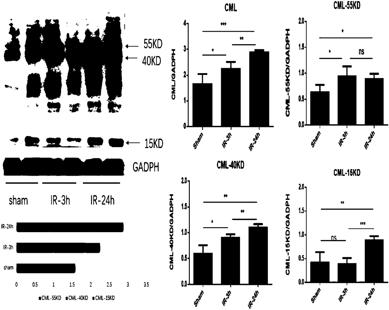 Advanced glycosylation end product CML as early diagnosis marker of myocardial ischemia reperfusion injury and application thereof