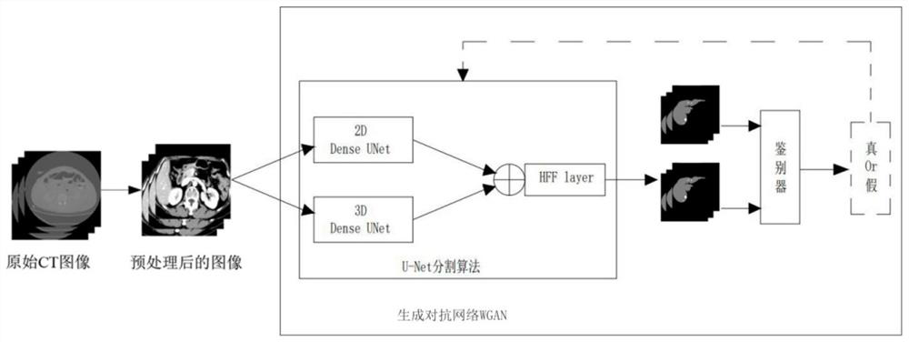 Liver CT tumor segmentation and classification method based on deep learning