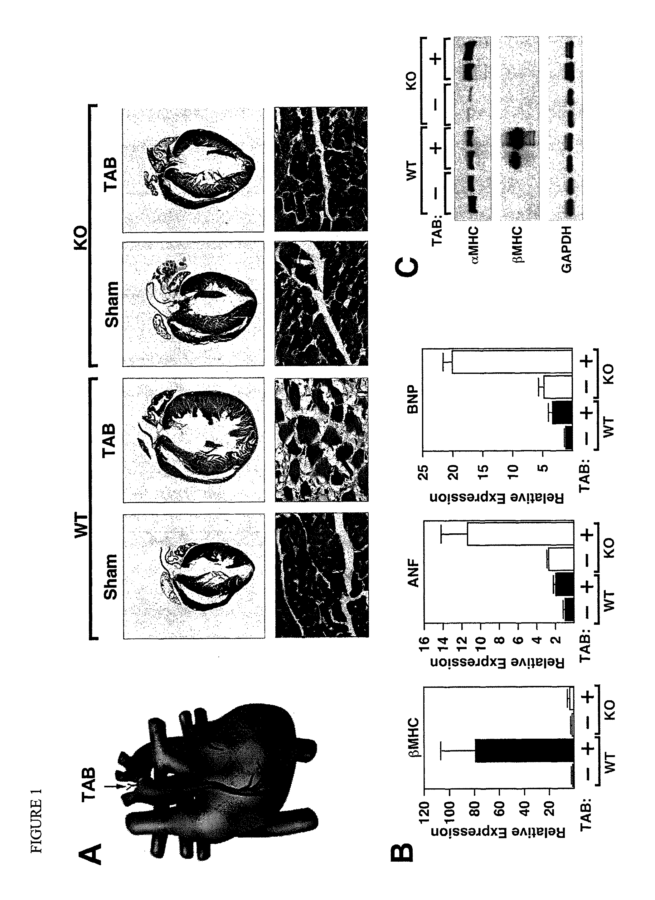 Dual targeting of MIR-208 and MIR-499 in the treatment of cardiac disorders