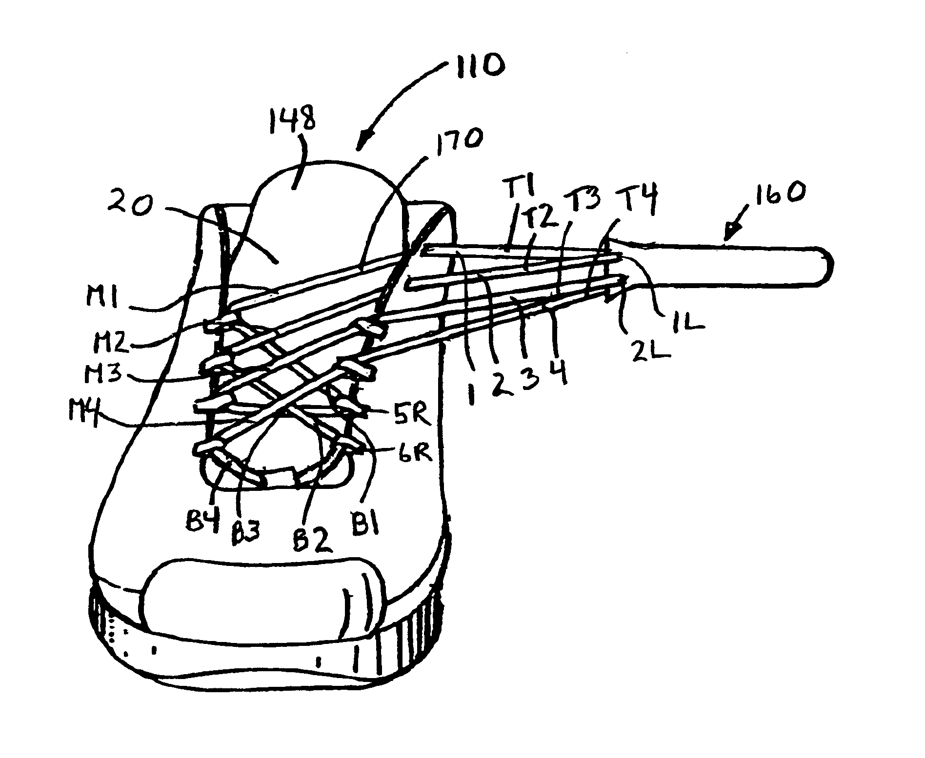 Lacing system