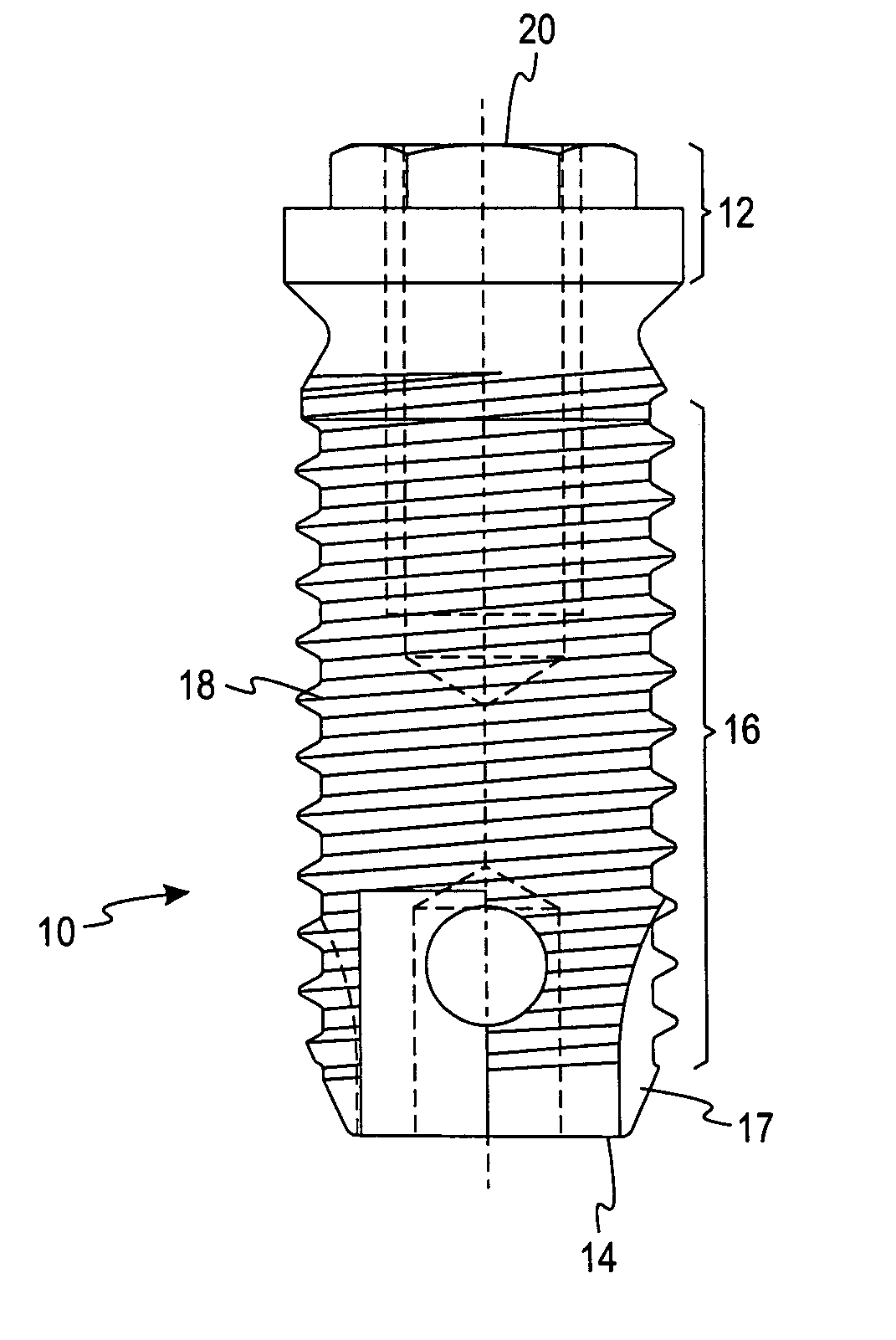 Deposition of discrete nanoparticles on an implant surface