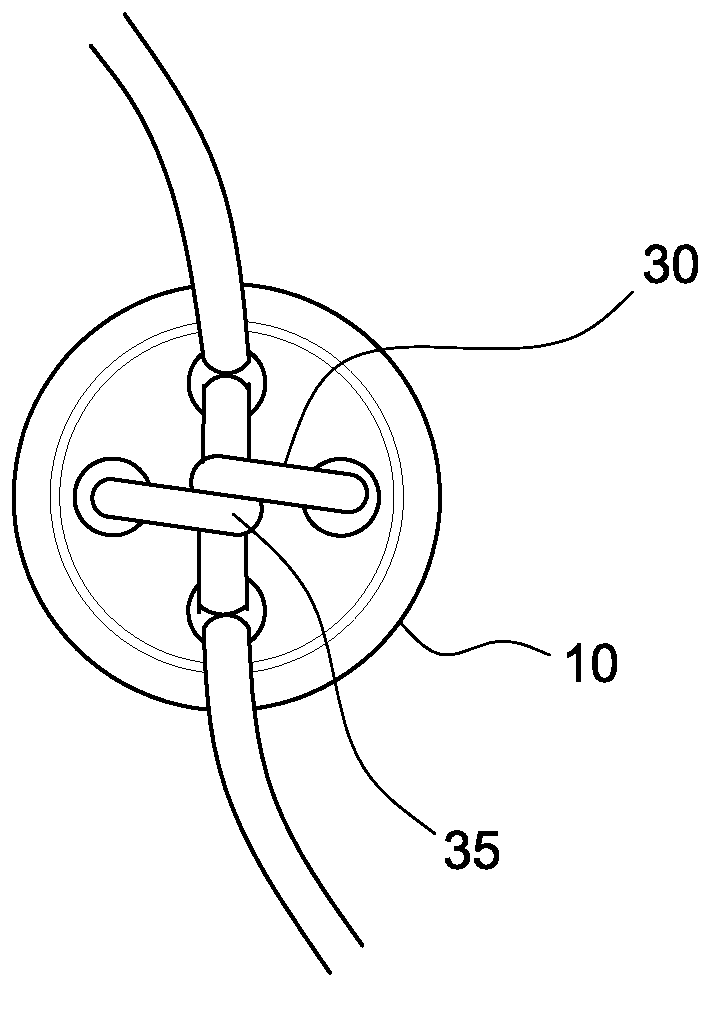 Adjustable suture-button construct for ankle syndesmosis repair